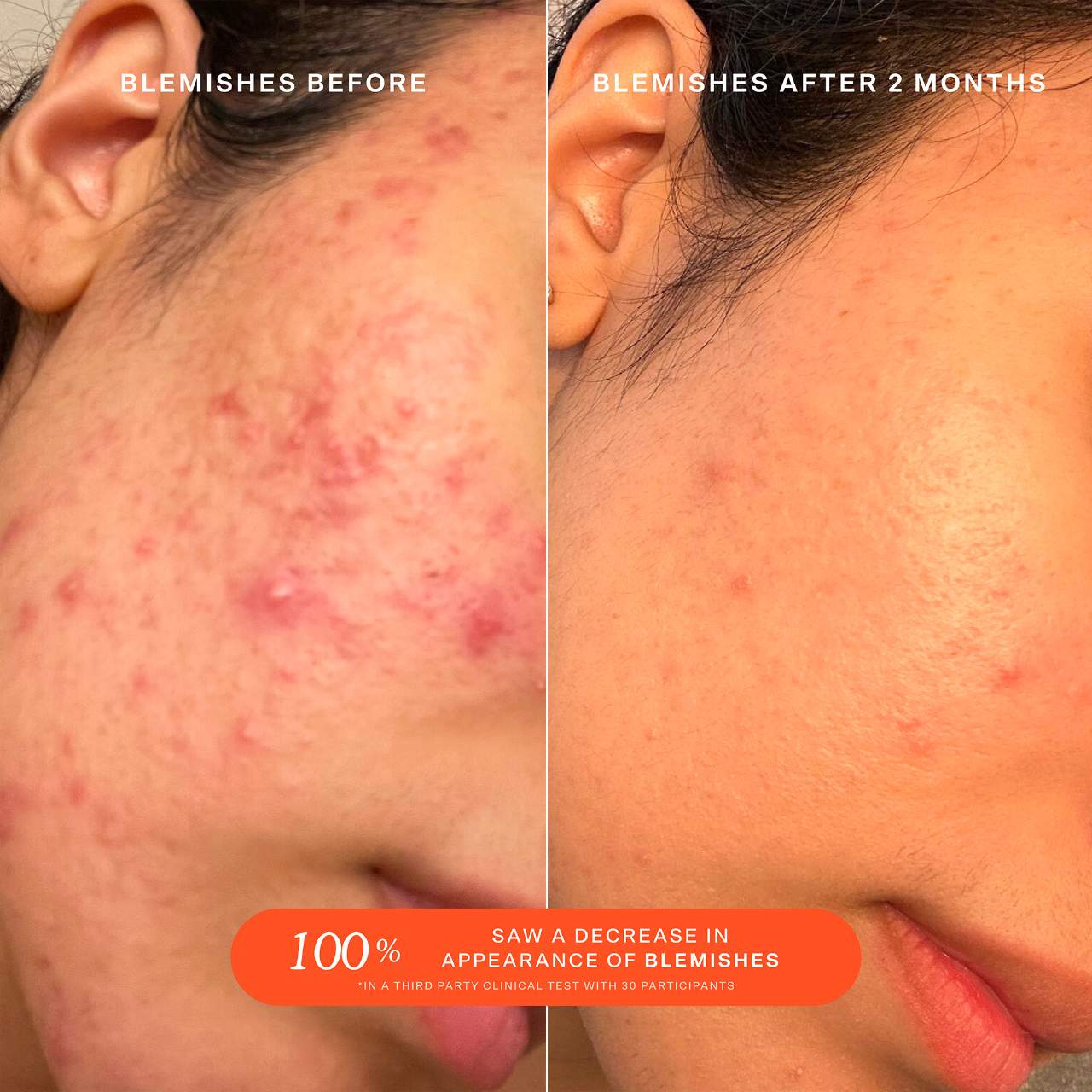 Pre orden: Tower 28 Beauty | SOS Daily Rescue Facial Spray with Hypochlorous Acid
