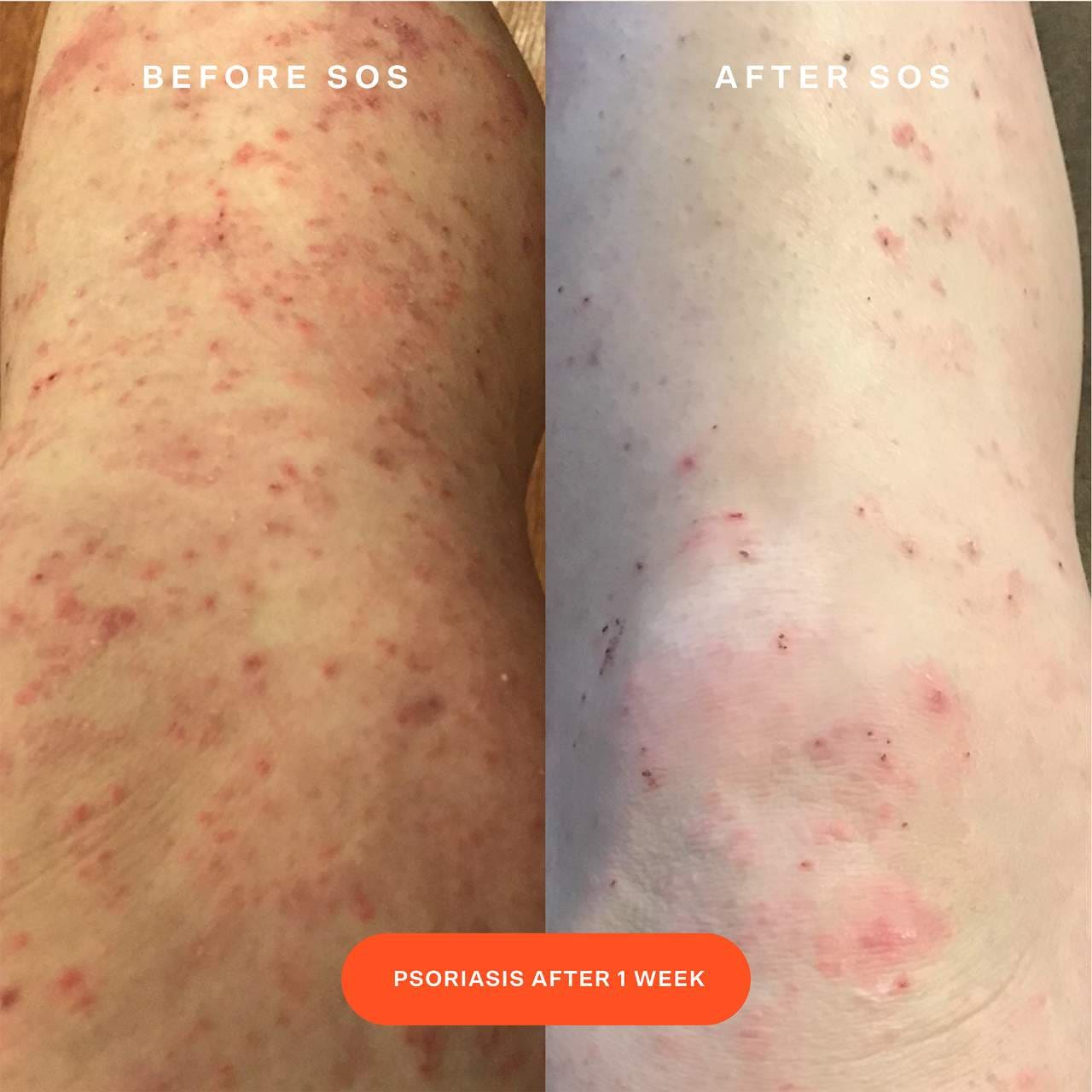 Pre orden: Tower 28 Beauty | SOS Daily Rescue Facial Spray with Hypochlorous Acid