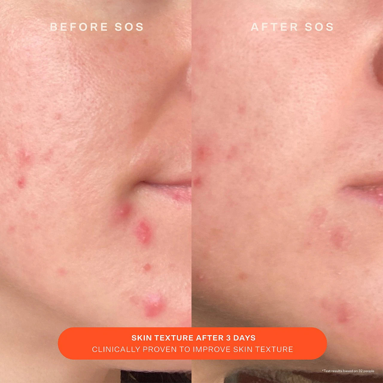 Pre-order: Tower 28 Beauty | SOS Daily Skin Barrier Redness Recovery Moisturizer