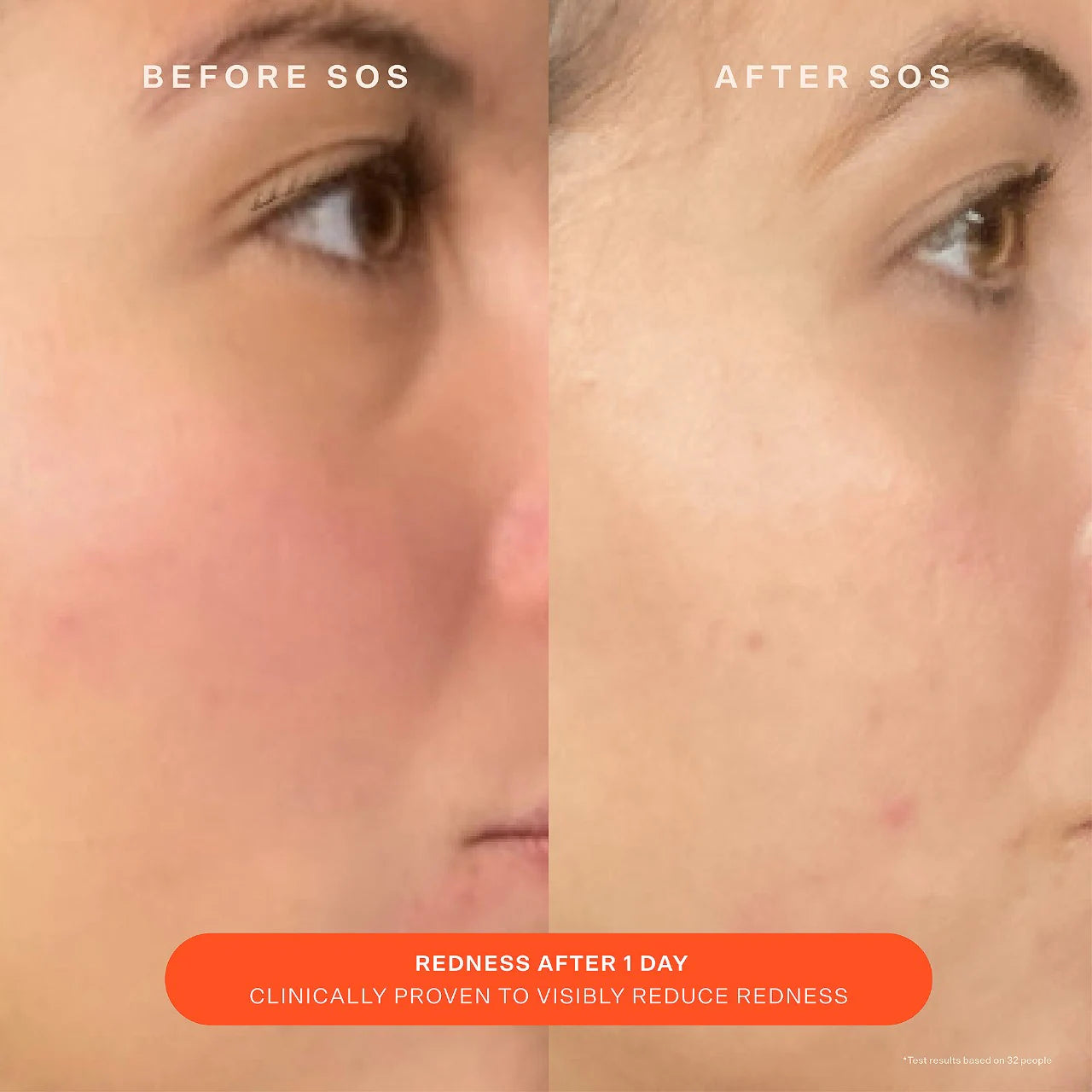 Pre-order: Tower 28 Beauty | SOS Daily Skin Barrier Redness Recovery Moisturizer