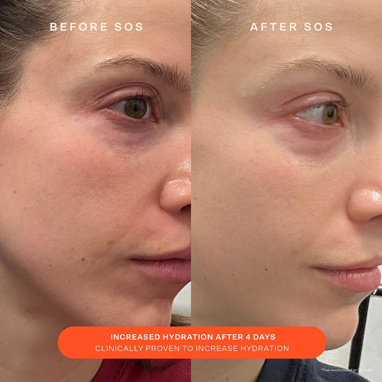 Pre-order: Tower 28 Beauty | SOS Daily Skin Barrier Redness Recovery Moisturizer