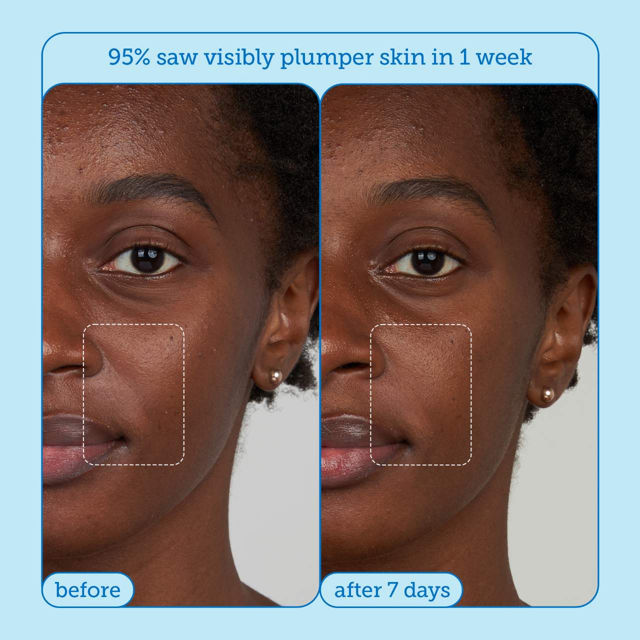 Pre orden: Skinfix | barrier+ Mini Bestsellers Set