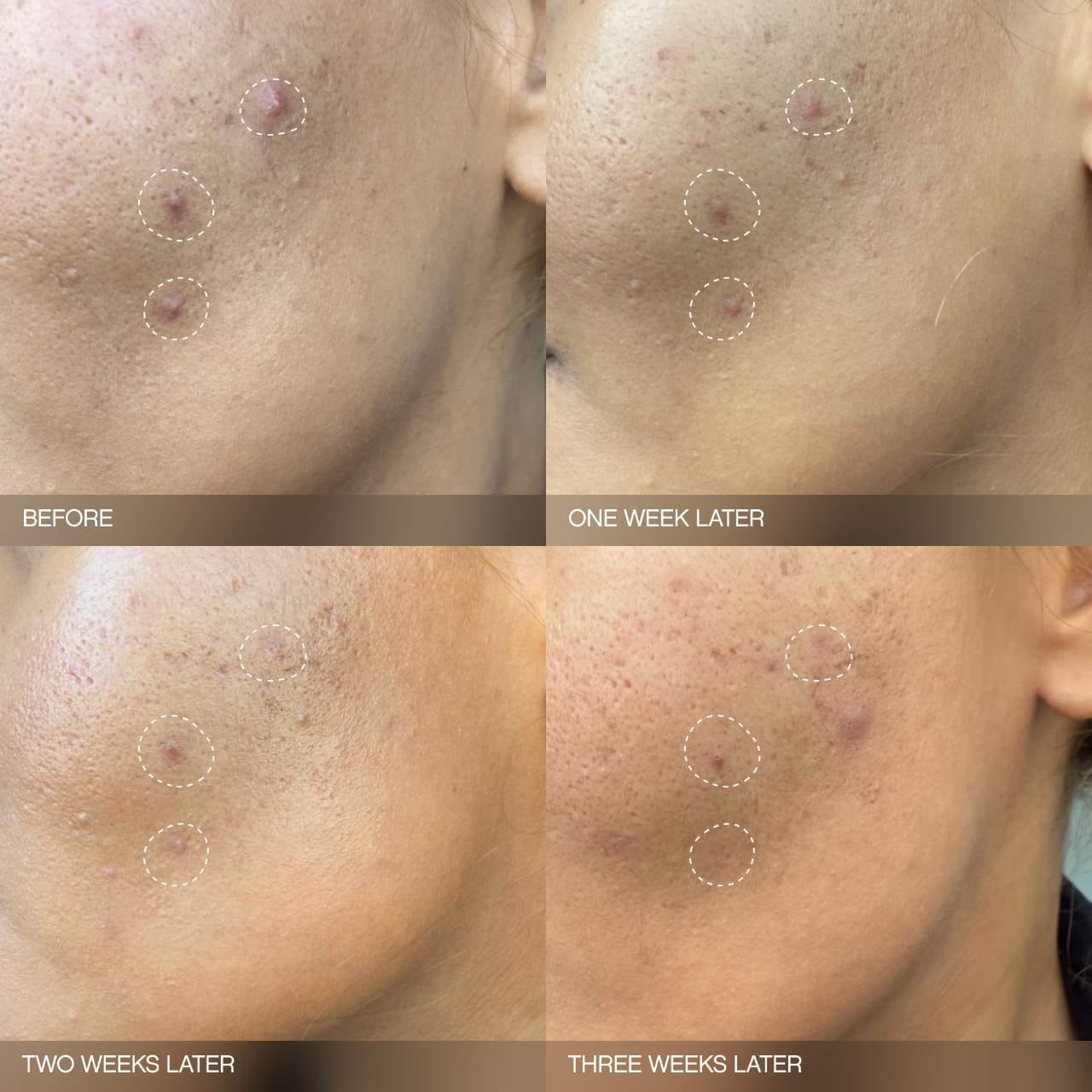 Pre-order: Topicals | Faded Brightening Bundle for Discoloration on Face & Body