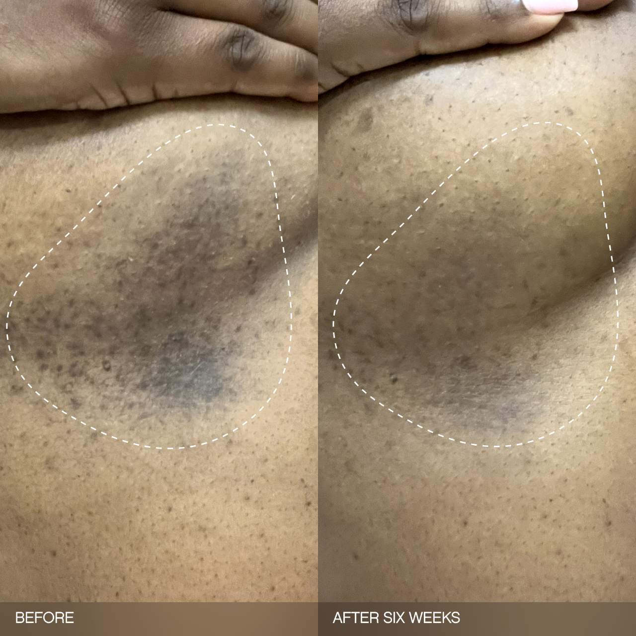 Pre-order: Topicals | Faded Brightening Bundle for Discoloration on Face & Body