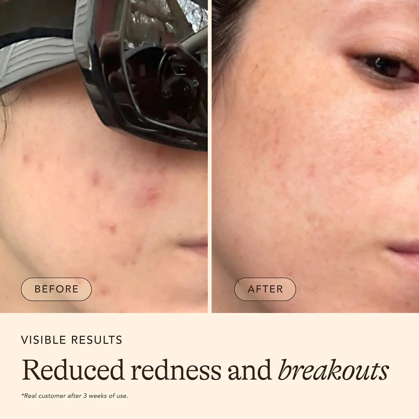 Pre-orden: Dezi Skin | Claro Que C Vitamin C Glow Serum