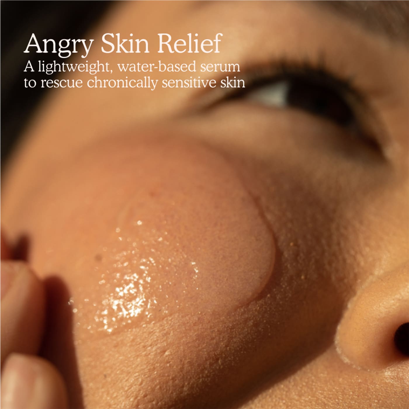 Pre orden: Tower 28 Beauty | SOS Intensive Redness Relief Serum with Hypochlorous Acid