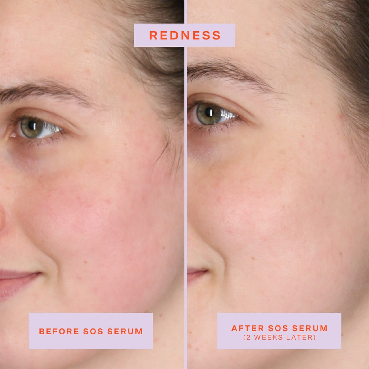 Pre orden: Tower 28 Beauty | SOS Intensive Redness Relief Serum with Hypochlorous Acid