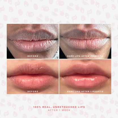 Pre-orden: Tower 28 | SOS LipSoftie® Lip Treatment