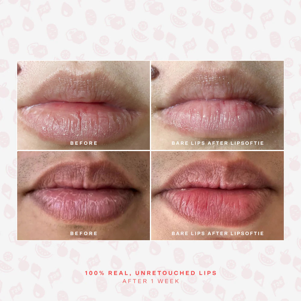Pre-orden: Tower 28 | LipSoftie® Lip Treatment