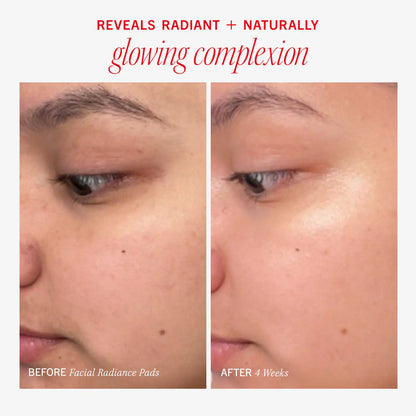 Pre-orden: First Aid Beauty | Facial Radiance Pads with Glycolic + Lactic Acids – Exfoliating Pads with AHA