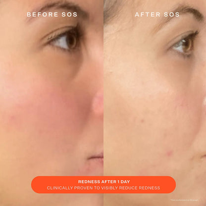 Pre-order: Tower 28 Beauty | SOS Daily Skin Barrier Redness Recovery Moisturizer