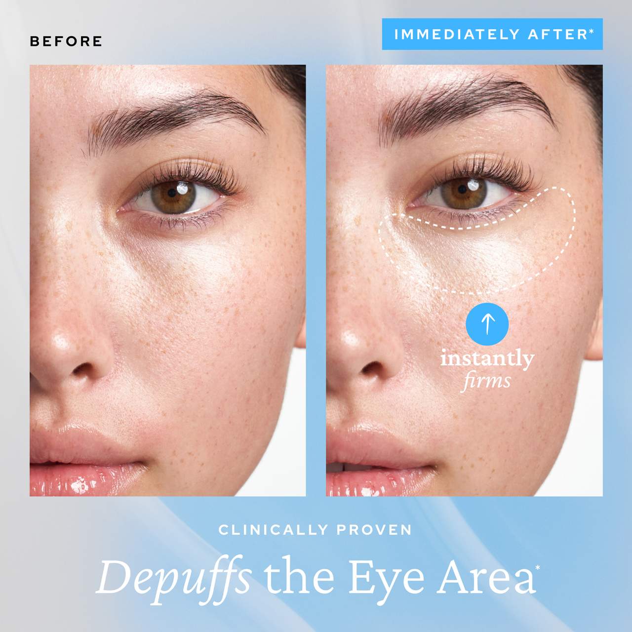 Pre-orden:  belif | Aqua Bomb Depuffing Eye Gel with Caffeine + Hyaluronic Acid