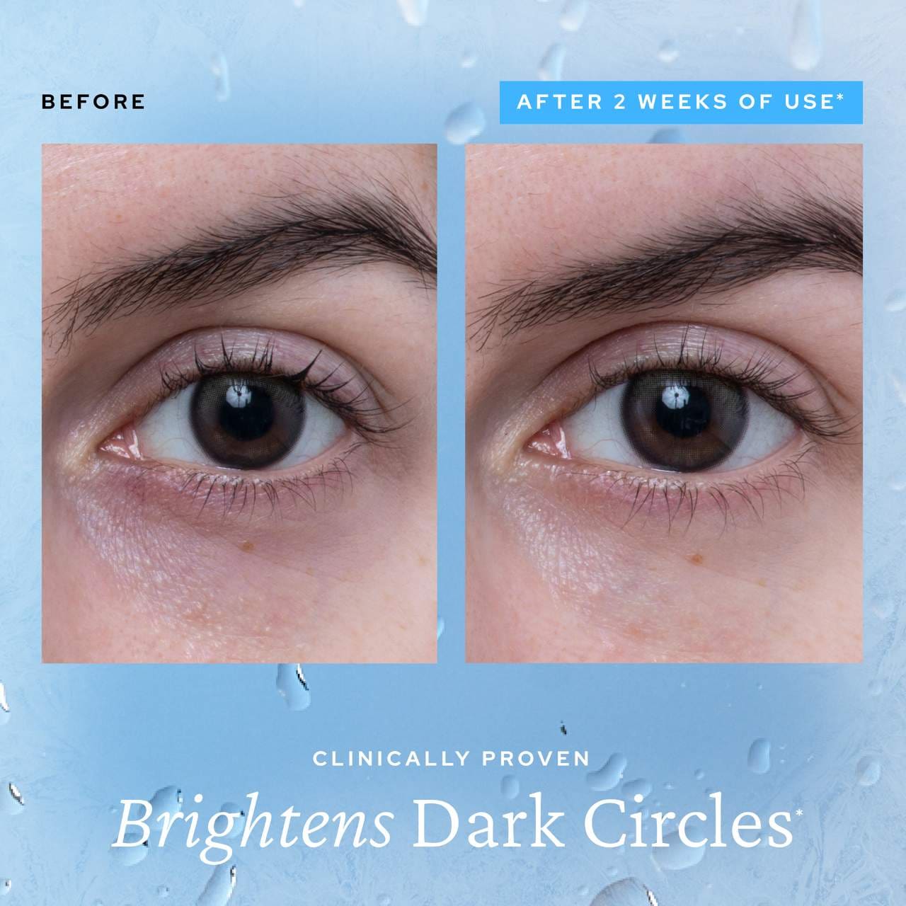 Pre-orden:  belif | Aqua Bomb Depuffing Eye Gel with Caffeine + Hyaluronic Acid