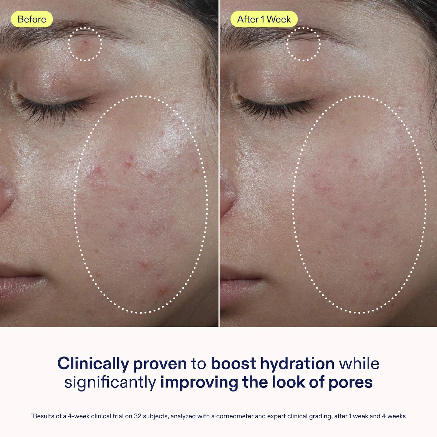 Skinfix | Barrier Balancing Water Cream Moisturizer with Hyaluronic Acid (Crema Hidratante en Gel para Equilibrar la Barrera con Ácido Hialurónico) | Pre-orden