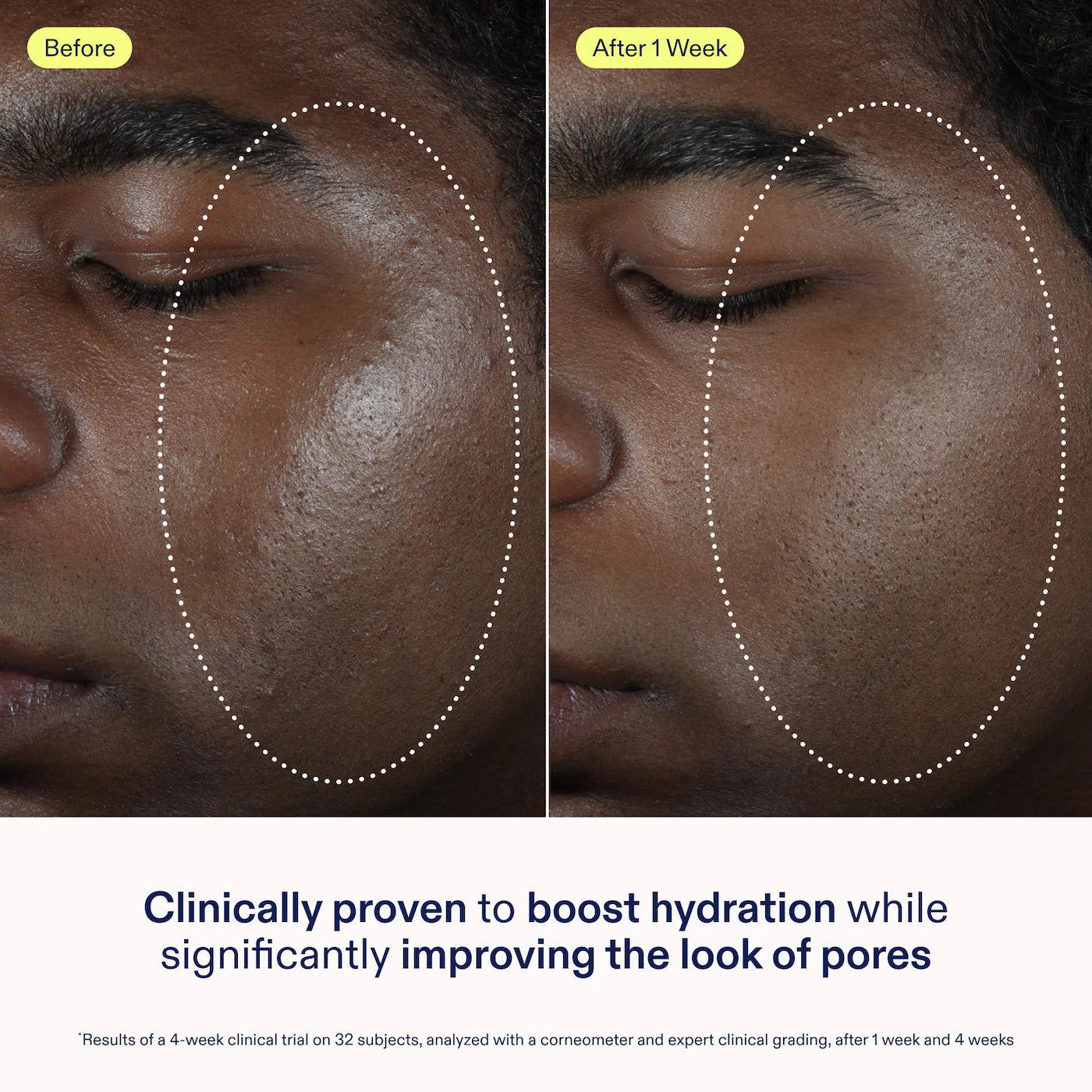 Skinfix | Barrier Balancing Water Cream Moisturizer with Hyaluronic Acid (Crema Hidratante en Gel para Equilibrar la Barrera con Ácido Hialurónico) | Pre-orden