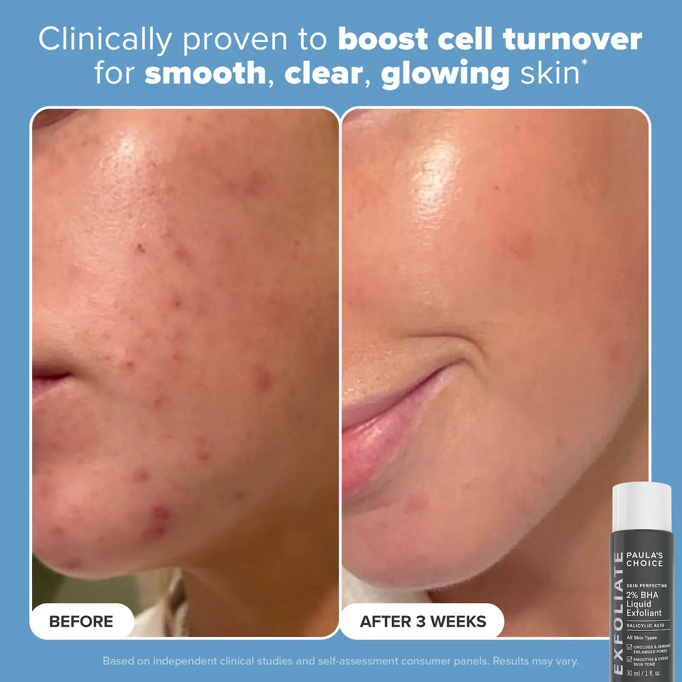 Pre-order: Paula's Choice | Mini Must-Haves with 2% BHA Exfoliating Toner, Foaming Cleanser, & SPF 50