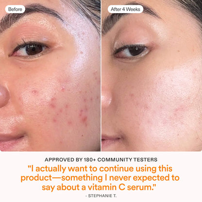 Skinfix | Barrier+ 15% Vitamin C & Ferulic Acid Serum | Pre-orden