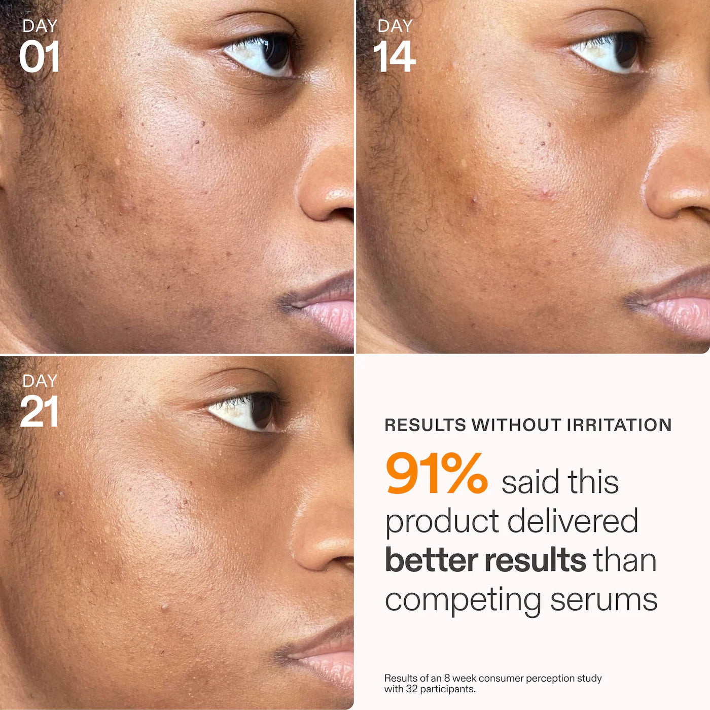 Skinfix | Barrier+ 15% Vitamin C & Ferulic Acid Serum | Pre-orden