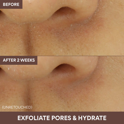 Pre-order: innisfree | Volcanic Swirl Exfoliating Pore Mask