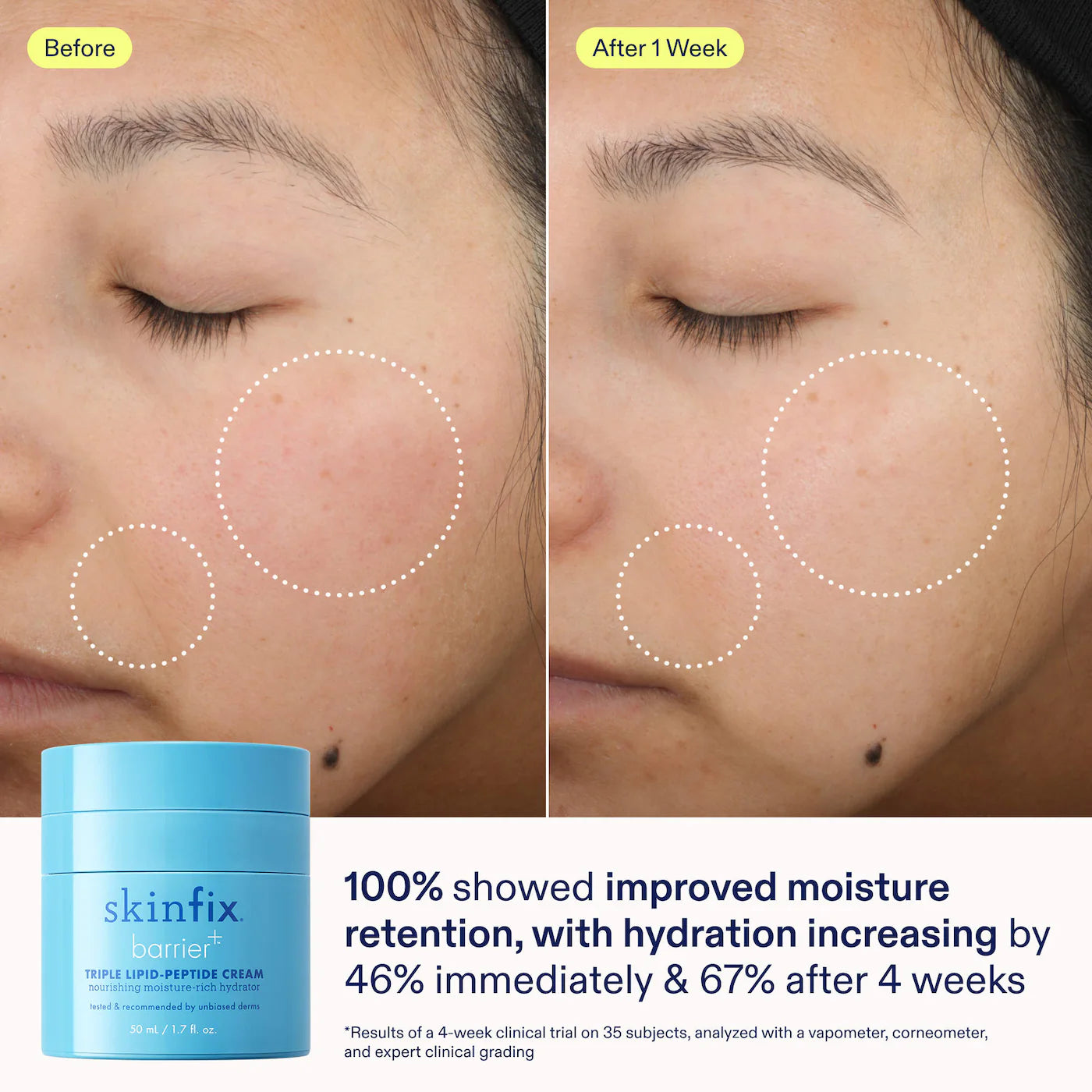 Pre-orden: Skinfix | Ultimate Hydration Jet Set