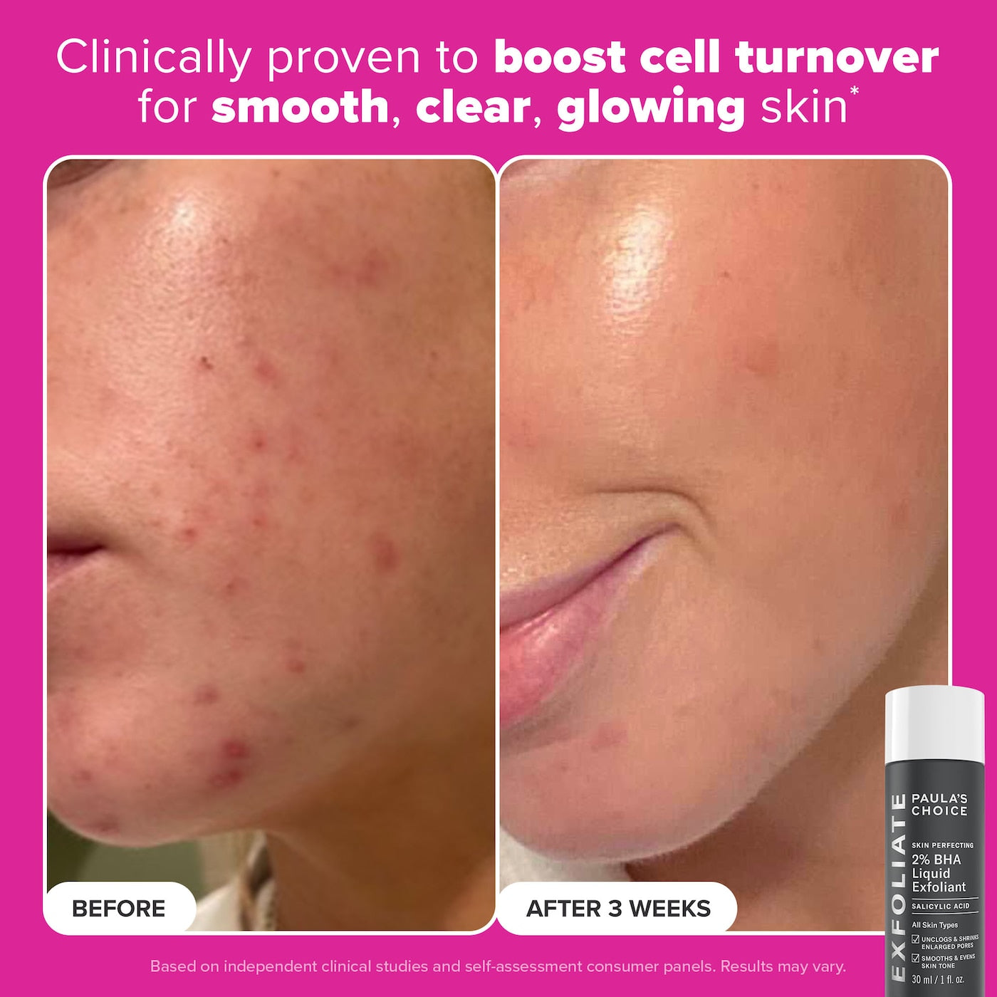 Pre-orden: Paula's Choice | Plump & Glow 3-Step Kit for Clear, Firm Skin
