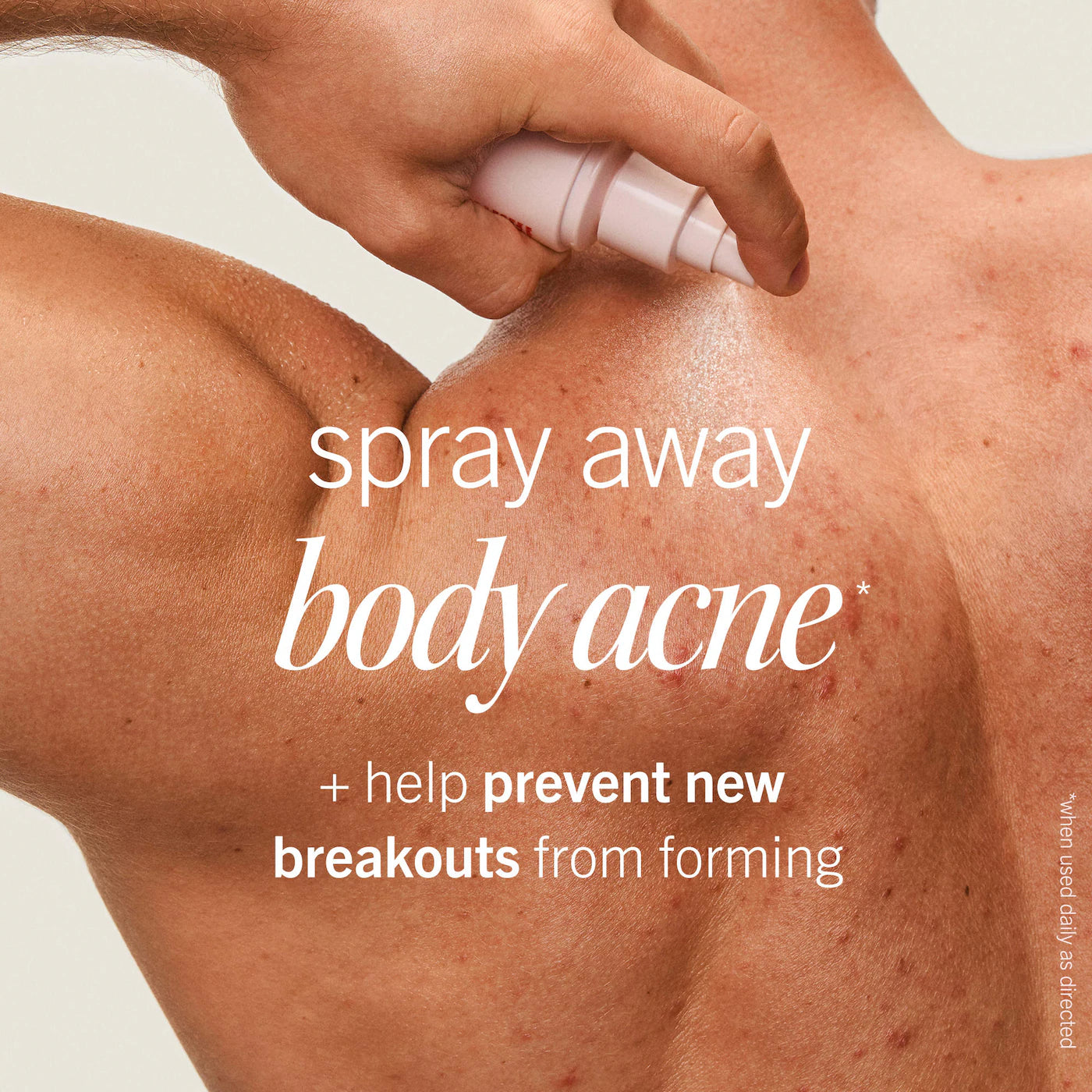 Pre-order: First Aid Beauty | Body Acne Clearing Mist  - 2% Salicylic Acid Acne Treatment