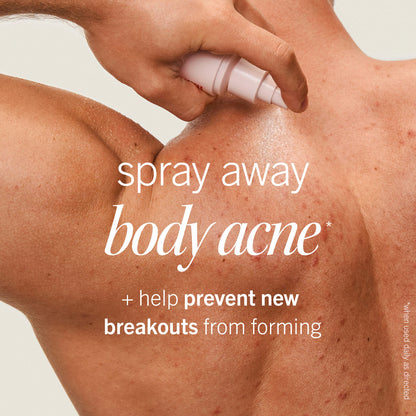 Pre-order: First Aid Beauty | Body Acne Clearing Mist  - 2% Salicylic Acid Acne Treatment