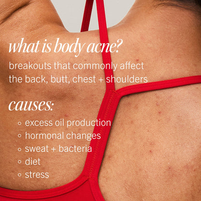 Pre-order: First Aid Beauty | Body Acne Clearing Mist  - 2% Salicylic Acid Acne Treatment