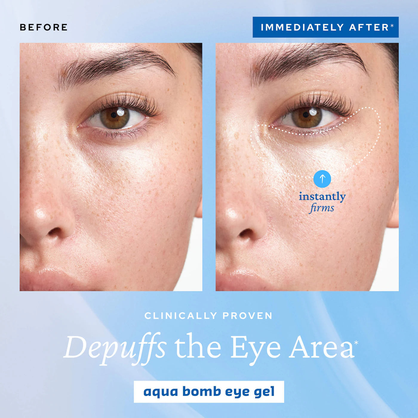 Pre-orden: belif | Aqua Bomb Hydrating Eye & Moisturizer Duo Set