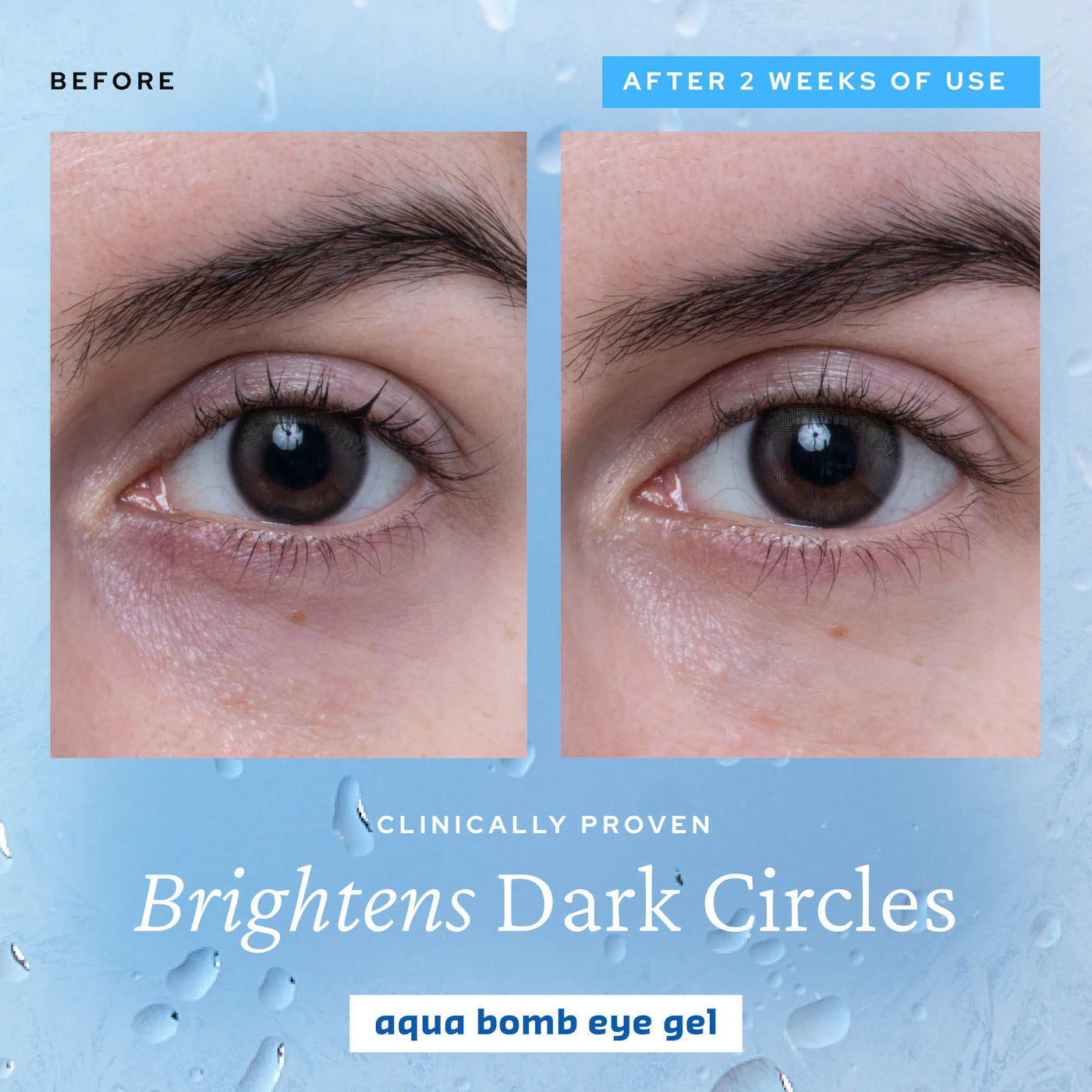 Pre-orden: belif | Aqua Bomb Hydrating Eye & Moisturizer Duo Set