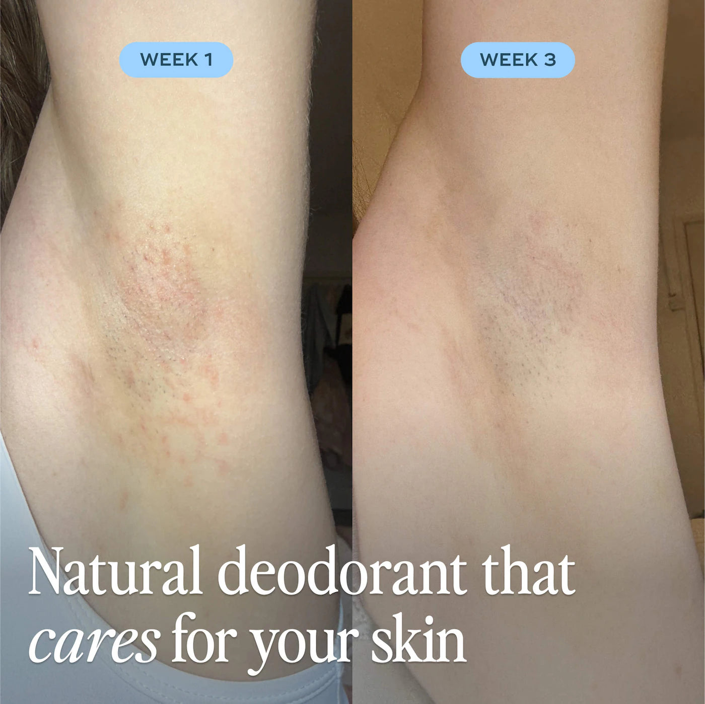 Pre-orden: Luna Daily | The Cooling All Over Deodorant™ - Extra-strength, Natural, Non-Staining, Aluminum Free Body Deodorant Stick