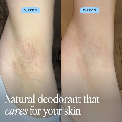 Pre-orden: Luna Daily | The Cooling All Over Deodorant™ - Extra-strength, Natural, Non-Staining, Aluminum Free Body Deodorant Stick