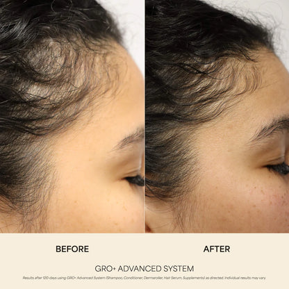 Pre-order: Vegamour | GRO+ Advanced Growth & Density Supplements for Hair Thinning and Loss