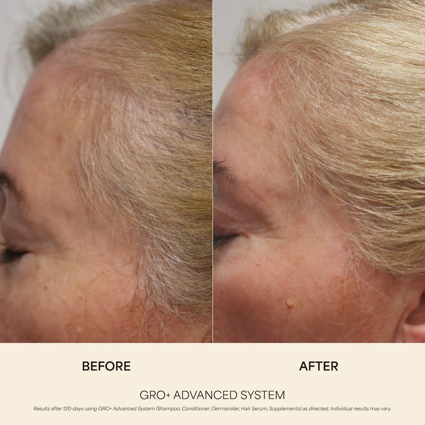 Pre-order: Vegamour | GRO+ Advanced Growth & Density Supplements for Hair Thinning and Loss