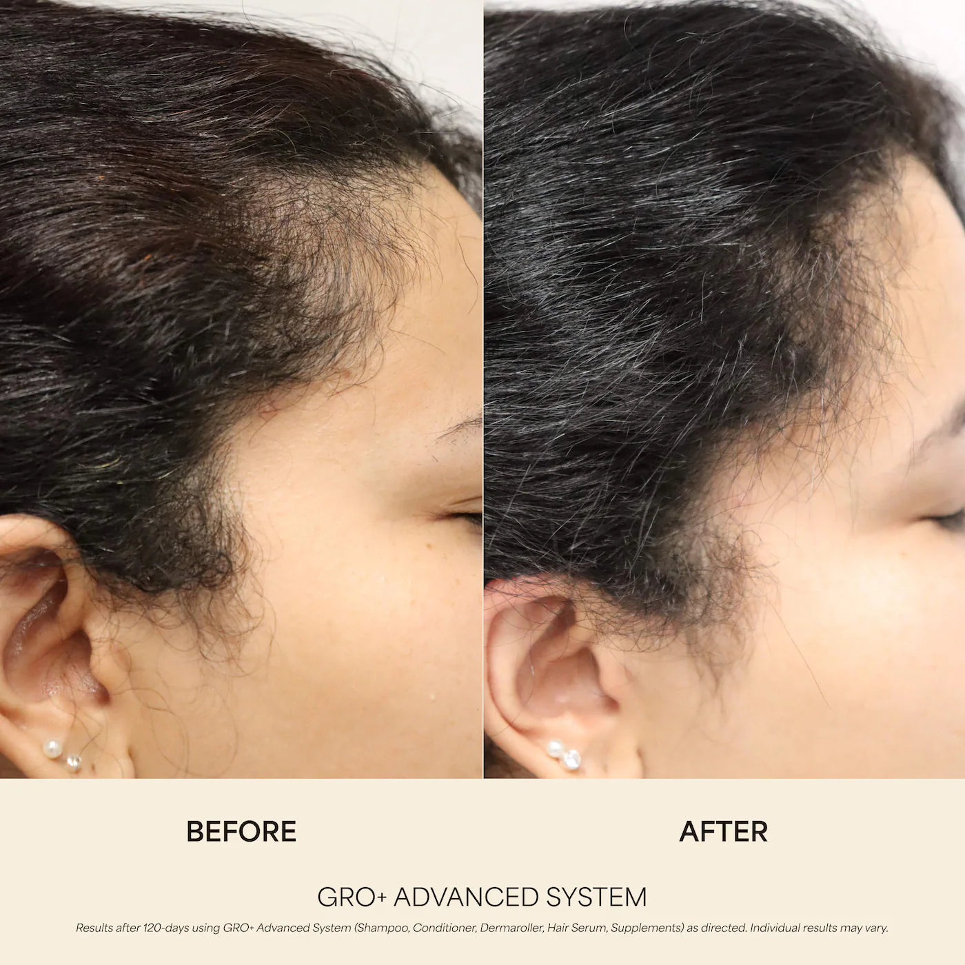 Pre-order: Vegamour | GRO+ Advanced Growth & Density Supplements for Hair Thinning and Loss