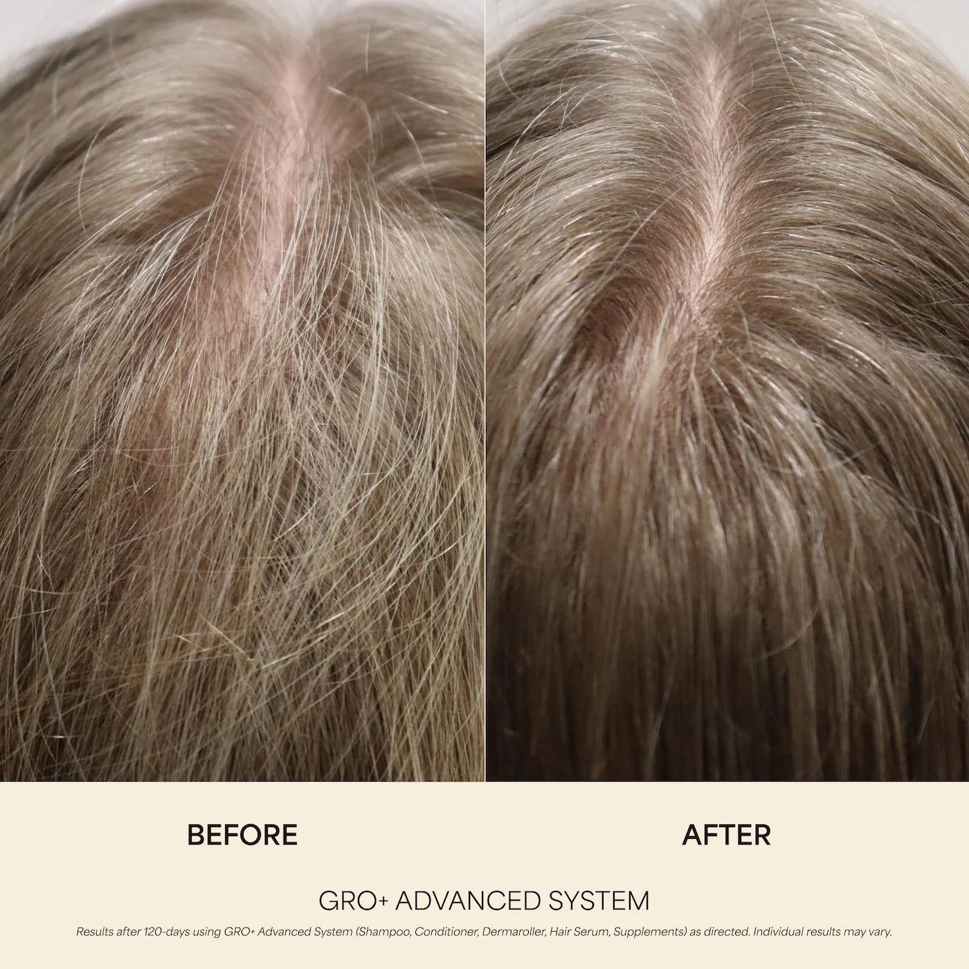 Pre-order: Vegamour | GRO+ Advanced Growth & Density Supplements for Hair Thinning and Loss