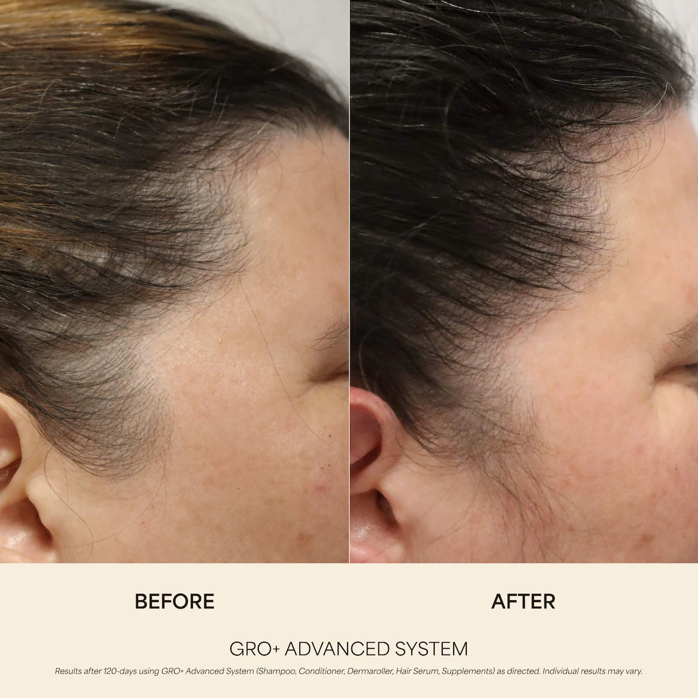 Pre-order: Vegamour | GRO+ Advanced Growth & Density Supplements for Hair Thinning and Loss