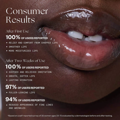 Pre-orden:VIOLETTE_FR | BALM AMOUR Nourishing Lip Treatment with Peptides