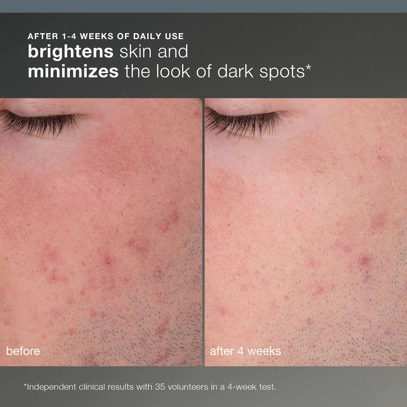 Pre-orden: Dermalogica | Daily Microfoliant Refillable Exfoliator | Daily Microfoliant First Snow Of The Season Set