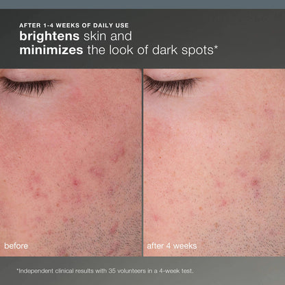 Pre-orden: Dermalogica | Daily Microfoliant Refillable Exfoliator | Daily Microfoliant First Snow Of The Season Set