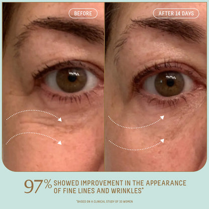 Pre-orden: Biossance | Uplifting Glow Skincare Set