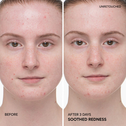 innisfree | Green Tea Ceramide Milk Toner for Hydration & Barrier Repair | Pre-orden