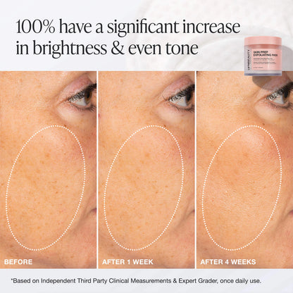 INNBEAUTY PROJECT | Skin Prep Brightening & Exfoliating Pads with Glycolic Acid (Pads Iluminadores y Exfoliantes con Ácido Glicólico) | Pre-orden