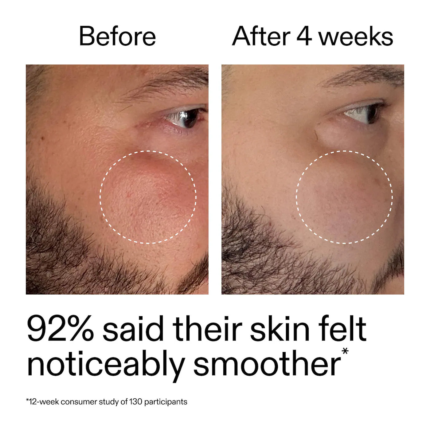 The INKEY List | Starter Retinol Serum for Fine lines + Wrinkles (Sérum Facial con Retinol para Principiantes para Líneas Finas y Arrugas) | Pre-orden