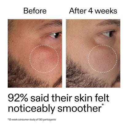 The INKEY List | Starter Retinol Serum for Fine lines + Wrinkles (Sérum Facial con Retinol para Principiantes para Líneas Finas y Arrugas) | Pre-orden