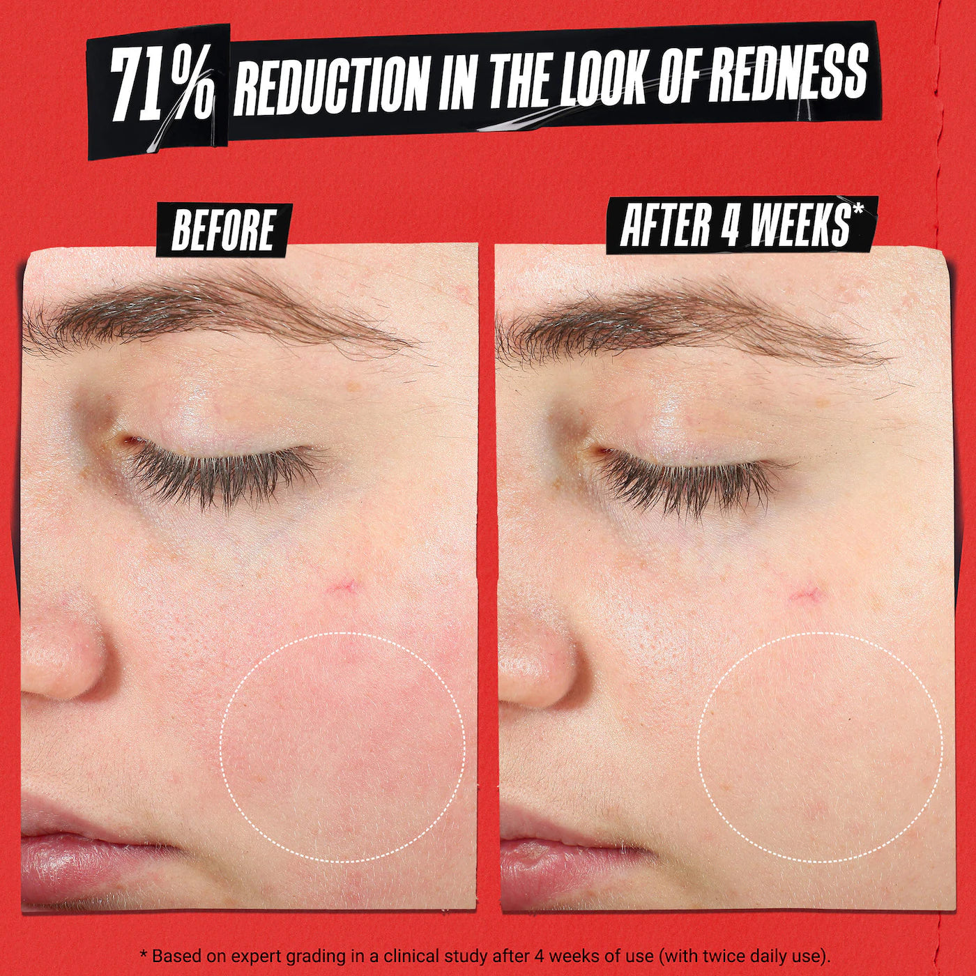 Kiehl's | Ultra Facial Meltdown Recovery Medicated Cream with Colloidal Oatmeal (Crema Facial Calmante y Reparadora con Avena Coloidal) | Pre-orden