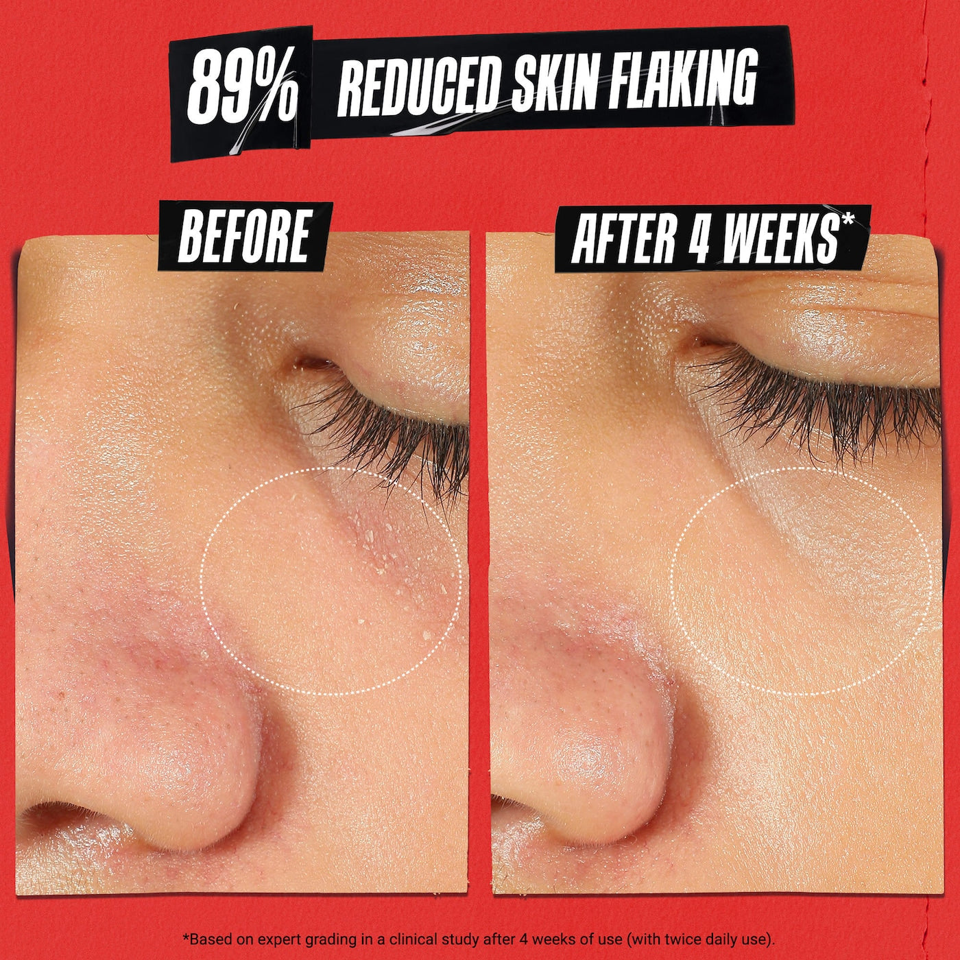 Kiehl's | Ultra Facial Meltdown Recovery Medicated Cream with Colloidal Oatmeal (Crema Facial Calmante y Reparadora con Avena Coloidal) | Pre-orden