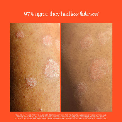 Tower 28 Beauty | SOS Rescue + Relief Body Wash Treatment (Gel de Limpieza Corporal Calmante)  | Pre-orden