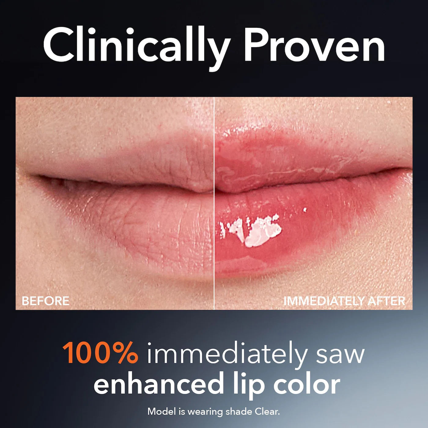 Dr. Dennis Gross Skincare | Mini Size: DermInfusions™ Plump + Repair Lip Treatment with Hyaluronic Acid (Tratamiento Labial Reparador y Voluminizador con Ácido Hialurónico) | Pre-orden