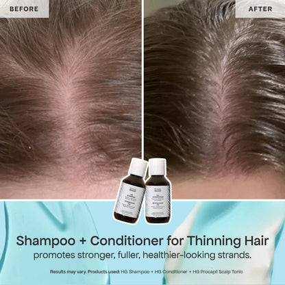 BondiBoost | Bondi Besties Minis Hair Gift Set for Hair Thinning (Minis Set Capilar para Cabello Delgado y con Caída) | Pre-orden